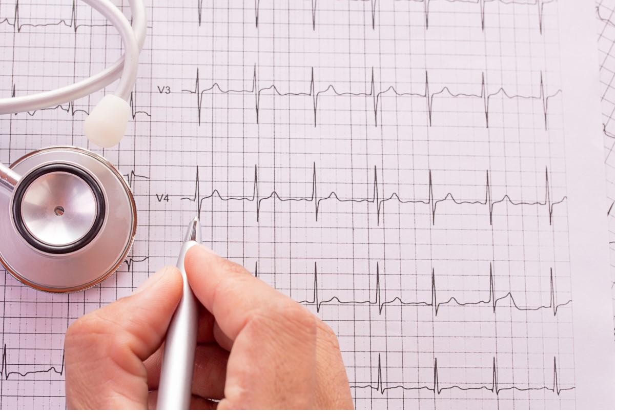 Eletrocardiograma