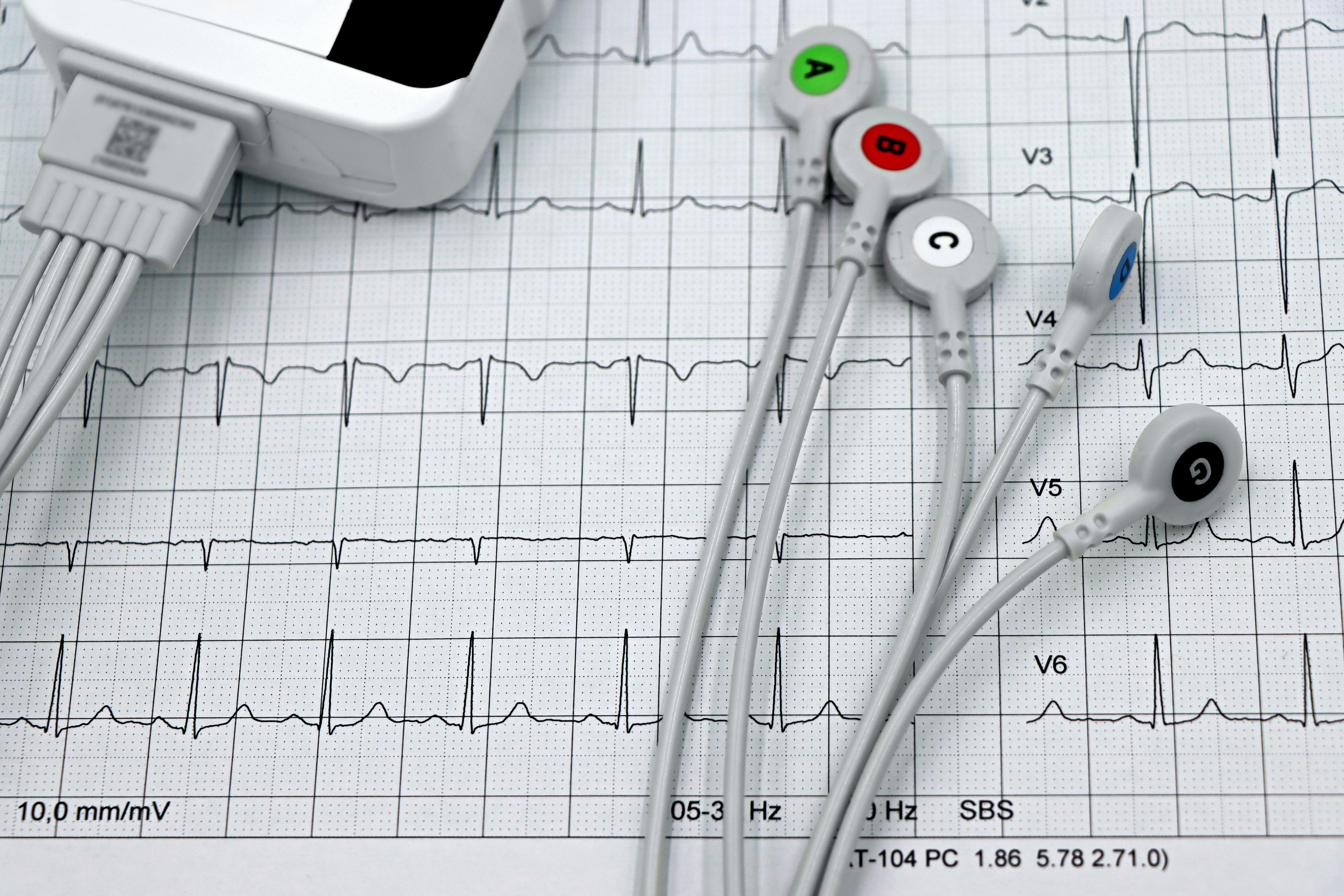 Holter 24 horas